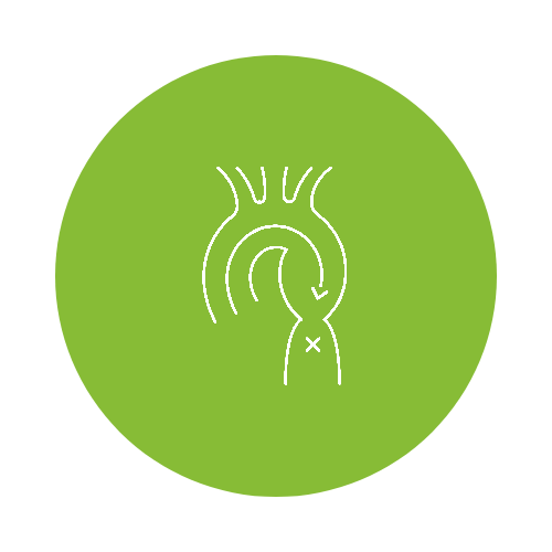abdominal-aorta-screening