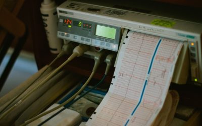 Blog 4 What Is a Stress Echo Test? Inside the Cardiac Screening Built for Police