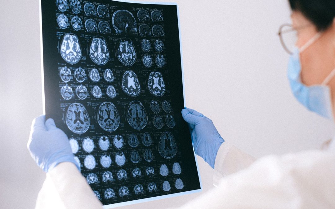 Calcium Score by Age: The Heart Number Your Workforce Should
